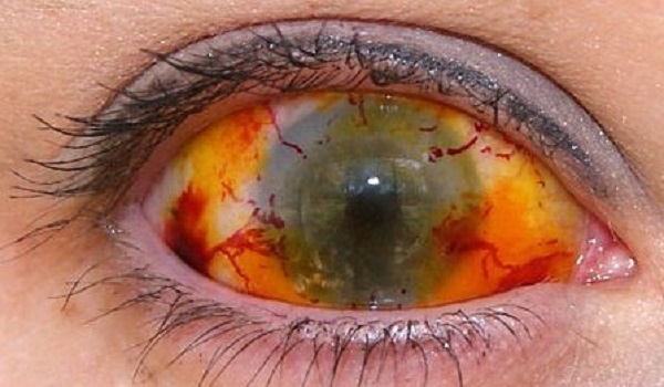 eye_of_death